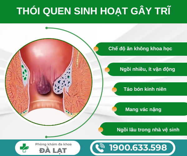 Hình ảnh minh họa